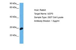 UCP3 Antibody, Novus Biologicals 100 &mu;L; Unconjugated:Antibodies, Polyclonal